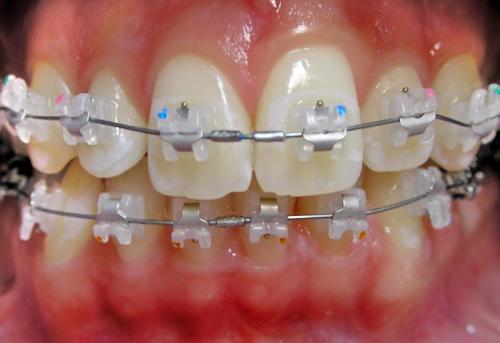 Orthodontics